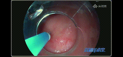 1647478544428312IzJy.gif 7.gif